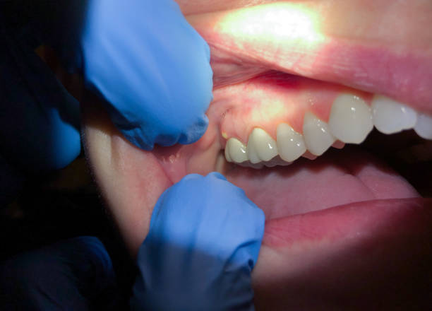 Best Pediatric Emergency Dentist in Plainfield, IL