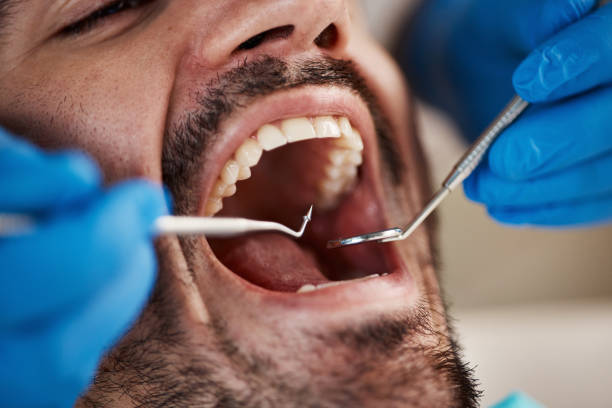 Best Emergency Root Canal Treatment in Plainfield, IL
